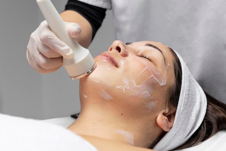 Chemical Peels Adelaide